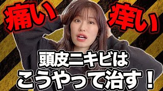 頭皮が痒い！痛い！突然できる頭皮ニキビの原因は〇〇！？表参道美容師が徹底解説！ [upl. by Pitarys376]