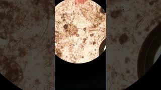 sarcoptic scabiei  sarcoptic mange canine scabies under microscope [upl. by Acinoda]