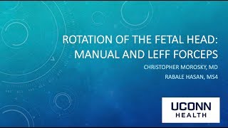 Rotation of the Fetal Head Manual and Leff Forceps [upl. by Anitsua]