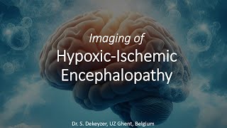 Imaging of HypoxicIschemic Encephalopathy [upl. by Peggi]