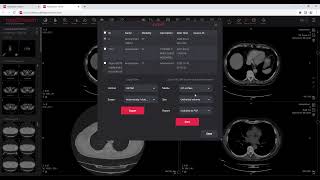 MedDream DICOM Viewer export [upl. by Anivol]