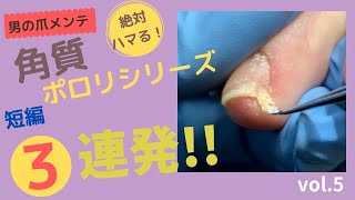 【フットケア】【footcare】爽快！角質動画短編集シリーズ第1弾！角質ポロリ3連発！！ [upl. by Justinn521]