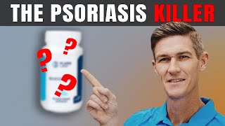 Best Supplement for Psoriasis Treatment  How to Get Rid of Psoriasis Naturally [upl. by Hemingway]