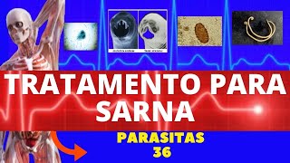 TRATAMENTO PARA SARNA HUMANA ESCABIOSE  SARCOPTES SCABIEI HOMINIS  PARASITOLOGIA  INFECTOLOGIA [upl. by Hong]