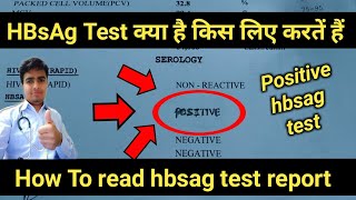 Hbsag Positive  hbsag test  hbsag test in hindi  hbsag test report  hepatitis b test results [upl. by Ahsikal621]