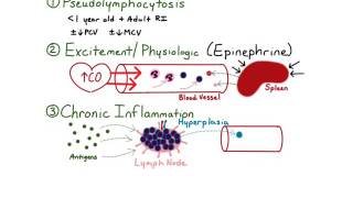 Lymphocytosis [upl. by Angelika]