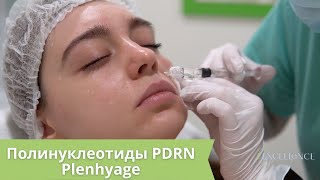 Инъекции Plenhyage  Полинуклеотиды PDRN для лица [upl. by Austin]