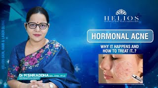 Treating Hormonal Acne  Dermatologist Tips Tamil  Dr M Shraddha [upl. by Atimed133]