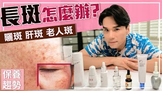 超強淡斑攻略，雀斑、曬斑、孕斑、老人斑一次搞懂！ll Kevin想得美 ll How To Remove Dark Spots On Face [upl. by Anestassia]