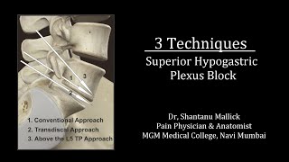 Superior Hypogastric Plexus Block 3 Techniques [upl. by Yolanthe]