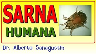 SARNA HUMANA 🐞 [upl. by Fleck]