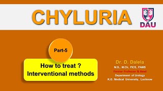 CHYLURIA treatment by interventional methods [upl. by Angelle]