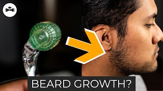 Derma Roller for Beard  What You Need to Know  Microneedling [upl. by Xel196]