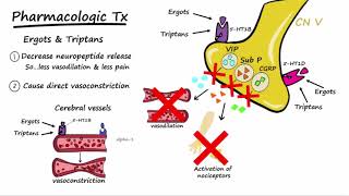 Migraines  Pathophysiology amp Treatment Described Concisely [upl. by Poucher904]