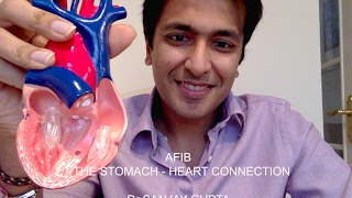 Afib The stomachheart connection [upl. by Wiersma358]