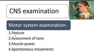 CNS Examination in Newborn  Newborn Examination Part9  Pediatrics [upl. by Akinit654]