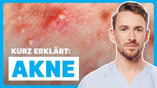 Akne bei Jugendlichen amp Erwachsenen Ursachen Symptome Diagnose amp Therapie  DocTommy [upl. by Eillah]