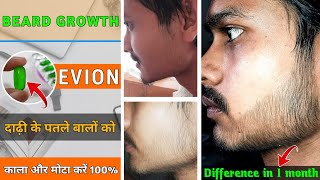 BEARD GROWTH  FROM EVION 400 □ Best beard growth soulation  दाढ़ी को मोटा और काला कैसे करें [upl. by Yaniv15]