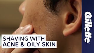 How to Shave with Acne and Oily Skin  Mens Skin Care Tips [upl. by Ikram937]