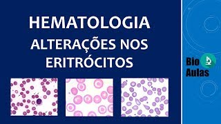 Anisocromia Anisocitose e Poiquilocitose Alterações no Hemograma Hematologia  Bio Aulas [upl. by Dlanod25]