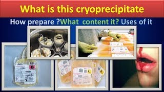 What is this cryoprecipitateHow prepareusescontent of it [upl. by Azeel]