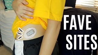 My Favorite Dexcom amp Omnipod Sites  Daily Diabetics  Laina [upl. by Nowell]