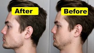 How To Get A Strong Chin And Jawline Lose Double Chin [upl. by Barhos]