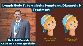 Lymph Node Tuberculosis Symptoms Diagnosis amp Treatment I Dr Ankit Parakh TB Specialist [upl. by Furlong]