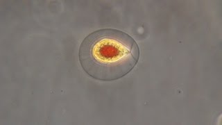 Haematococcus pluvialis the green algae that turn red [upl. by Jard586]