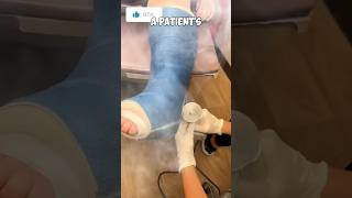 How to REMOVE a CAST🤯 Not Medical Advice shorts [upl. by Katee]