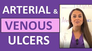 Arterial Ulcers vs Venous Ulcers Nursing Characteristics for PVD Peripheral Vascular Disease [upl. by Beryl421]