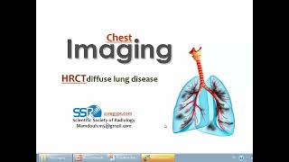 HRCT of diffuse lung disease I DRE Prof Mamdouh Mahfouz [upl. by Valda]