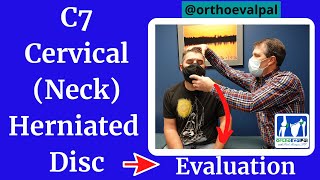 C7 Cervical neck Herniated Disc Evaluation [upl. by Anehs]