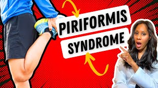 PIRIFORMIS SYNDROME CAUSES SYMPTOMS amp TREATMENTS A Doctor Explains [upl. by Tapes323]