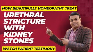 Urethral stricture treatment  किडनी स्टोन भी यूरेथ्रल स्ट्रिकचर बनाते हैं इसे होम्योपेथी से ठीक करे [upl. by Seel]