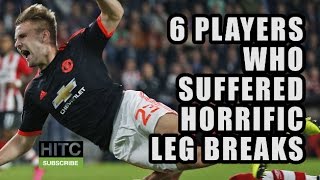 6 Players Who Suffered Horrific Leg Breaks [upl. by Waine603]