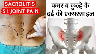 Sacroiliac Joint Pain Exercises  कमर व कूल्हे के दर्द का इलाज  Sacroiliitis treatment in hindi [upl. by Akinorev931]