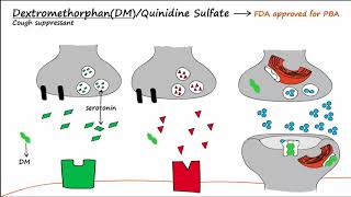 Pseudobulbar Affect PBA  Part 2  Treatment [upl. by Cohby]