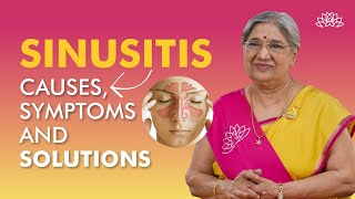 What is Sinusitis  Sinusitis Causes Symptoms amp Treatment  Sinus Infection  Dr Hansaji [upl. by Ninette]