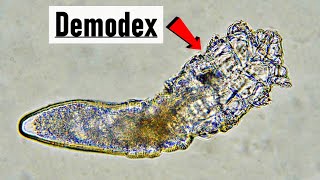 Live Demodex canis mite under microscope  10x magnification [upl. by Otirecul553]