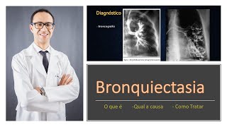 Bronquiectasia [upl. by Churchill]