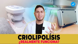 Criolipólisis Coolsulpting ¿Realmente funciona  DOCTOR LEMUS [upl. by Aletse]