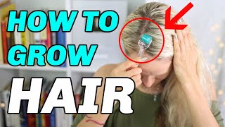 How to Dermaroll Hair for HAIR GROWTH  Flawless Technique [upl. by Jaynes924]