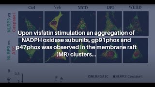 Membrane Raft Redox Signalling in VisfatinInduced Inflammasome Activation  AgingUS [upl. by Eerdua]