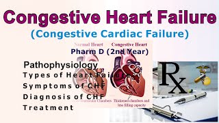 Congestive cardiac failure [upl. by Nesline]