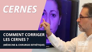 Comment corriger les cernes  comblement et pigmentation par médecine et chirurgie esthétique [upl. by Etnuahc]