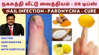 நகசுத்தி வந்தால் குணமாக வீட்டு வைத்தியம்nail skin infection home remedies paronychia dr karthikeyan [upl. by Marlee]