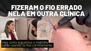 LEVANTAMOS ROSTINHO CAÍDO COM FIO DE SUSTENTAÇÃO [upl. by Anwahs]