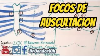 Focos de auscultación cardiaco facil y sencillo [upl. by Jt335]