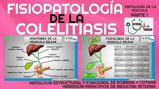 COLELITIASIS FISIOPATOLOGÍA GuiaMed [upl. by Croner]